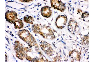 Immunohistochemistry (Paraffin-embedded Sections) (IHC (p)) image for anti-Heat Shock 70kDa Protein 8 (HSPA8) (AA 520-614) antibody (ABIN3043852)
