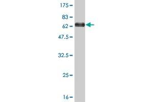 Western Blot detection against Immunogen (67. (MEIS2 抗体  (AA 1-381))