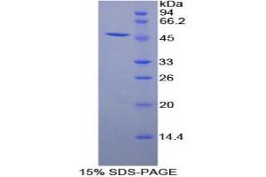 SDS-PAGE analysis of Human Adiponectin Receptor 1 Protein. (Adiponectin Receptor 1 Protein (ADIPOR1))