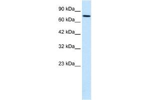 WB Suggested Anti-WHSC1 Antibody Titration:  0. (WHSC1 抗体  (N-Term))
