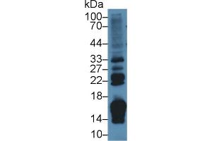 Western Blot; Sample: Rat Small intestine lysate; Primary Ab: 2µg/ml Rabbit Anti-Rat RBP2 Antibody Second Ab: 0. (RBP2 抗体  (AA 1-134))