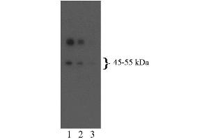 Western blot analysis for 5-HT2BR (second panel). (Serotonin Receptor 2B 抗体  (AA 1-58))