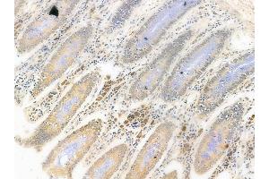 ABIN6261965 and ABIN6278698 at 1/100 staining human normal colon tissue by IHC-P.