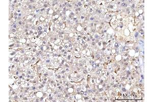 IHC analysis of RBP1 using anti-RBP1 antibody (ABIN7599586). (RBP1 抗体  (AA 10-135))
