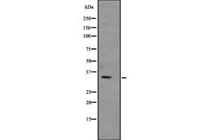Western blot analysis of TNNT3 expression in Human skeletal muscle lysate; Mouse skeletal muscle lysate; Rat skeletal muscle lysate,The lane on the left is treated with the antigen-specific peptide. (TNNT3 抗体  (C-Term))