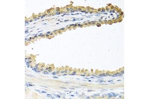 Immunohistochemistry of paraffin-embedded human prostate using COCH antibody (ABIN6132126, ABIN6138819, ABIN6138820 and ABIN6222234) at dilution of 1:100 (40x lens). (COCH 抗体  (AA 20-260))