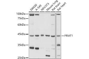 Western blot analysis of extracts of various cell lines, using PRMT1 antibody (ABIN3021311, ABIN3021312, ABIN3021313 and ABIN6214838) at 1:1000 dilution. (PRMT1 抗体  (AA 20-353))