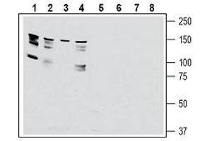 anti-Adhesion G-Protein Coupled Receptor G6 (ADGRG6) (AA 753-767), (Extracellular) antibody