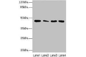 Western Blot All lanes: CBWD2 antibody at 6 μg/mL Lane 1: Mouse heart tissue Lane 2: Mouse liver tissue Lane 3: Mouse lung tissue Lane 4: Hela whole cell lysate Secondary Goat polyclonal to rabbit IgG at 1/10000 dilution Predicted band size: 45 kDa Observed band size: 45 kDa (CBWD2 抗体  (AA 96-395))