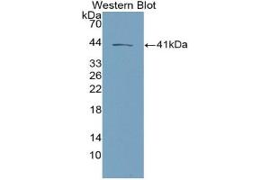 Detection of Recombinant NKB, Mouse using Polyclonal Antibody to Neurokinin B (NKB) (Tachykinin 3 抗体  (AA 29-101))