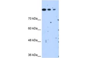 Western Blotting (WB) image for anti-SET Domain Containing 2 (SETD2) antibody (ABIN2463084) (SETD2 抗体)