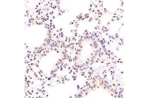 Immunohistochemistry analysis of paraffin-embedded mouse lung using,NCAPG2 (ABIN7074856) at dilution of 1: 1600 (NCAPG2 抗体)