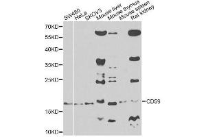 Western blot analysis of extracts of various cell lines, using CD59 antibody. (CD59 抗体)