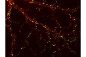 Indirect immunolabeling of PFA fixed rat hippocampus neurons with anti-SAP 102 (dilution 1 : 500; red) and mouse anti-synapsin 1 (cat. (DLG3 抗体)
