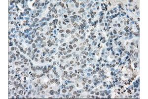 Image no. 2 for anti-P450 (Cytochrome) Oxidoreductase (POR) antibody (ABIN1497746) (POR 抗体)