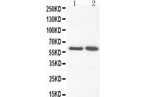 Anti-FMO3 antibody, Western blotting Lane 1: Rat Liver Tissue Lysate Lane 2: Rat Liver Tissue Lysate (FMO3 抗体  (N-Term))