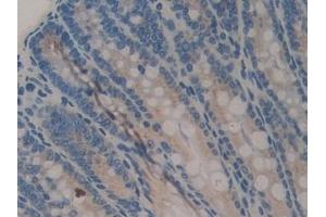 Detection of COMP in Mouse Colon Tissue using Polyclonal Antibody to Cartilage Oligomeric Matrix Protein (COMP) (COMP 抗体  (AA 554-753))