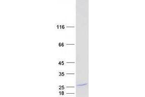 Western Blotting (WB) image for Myelin Basic Protein (MBP) (Transcript Variant 3) protein (Myc-DYKDDDDK Tag) (ABIN2726638)