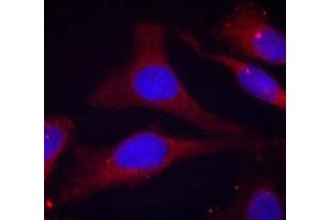 Immunofluorescence staining of methanol-fixed Hela cells using SHP-1(Phospho-Tyr536) Antibody. (SHP1 抗体  (pTyr536))