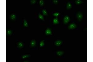 Immunofluorescence staining of A549 cells with ABIN7155365 at 1:133, counter-stained with DAPI. (HIST1H2AC 抗体  (AA 2-130))