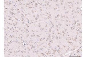 IHC analysis of RPL29 using anti-RPL29 antibody (ABIN7600993). (RPL29 抗体  (AA 27-153))