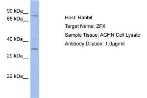 Host: Rabbit Target Name: ZFX Sample Type: ACHN Whole cell lysates Antibody Dilution: 1. (ZFX 抗体  (C-Term))