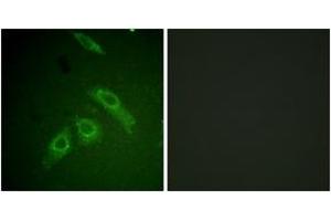 Immunofluorescence analysis of HepG2 cells, using FAK (Phospho-Ser910) Antibody. (FAK 抗体  (pSer910))
