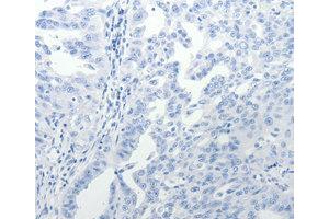 Immunohistochemistry (IHC) image for anti-USO1 Homolog, Vesicle Docking Protein (USO1) antibody (ABIN1875291) (USO1 抗体)