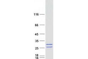 Western Blotting (WB) image for Mast Cell Expressed Membrane Protein 1 (MCEMP1) protein (Myc-DYKDDDDK Tag) (ABIN2725606)
