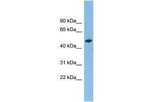 WB Suggested Anti-PTPRR Antibody Titration: 0. (PTPRR 抗体  (N-Term))