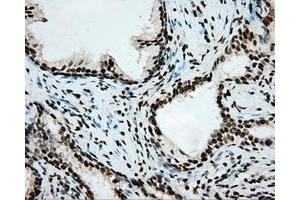 Image no. 3 for anti-Aryl Hydrocarbon Receptor Nuclear Translocator (ARNT) antibody (ABIN1496729) (ARNT 抗体)