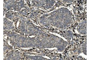 IHC analysis of Caspase-7/CASP7 using anti-Caspase-7/CASP7 antibody (ABIN7600823).