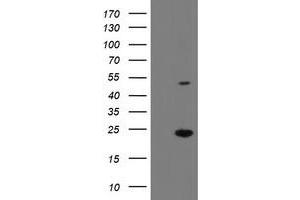 Western Blotting (WB) image for anti-Eukaryotic Translation Initiation Factor 5A2 (EIF5A2) antibody (ABIN1497996) (EIF5A2 抗体)
