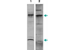 Western Blot (Cell lysate) analysis of nuclear extracts of ME-1 cells. (MYH11 抗体  (C-Term))