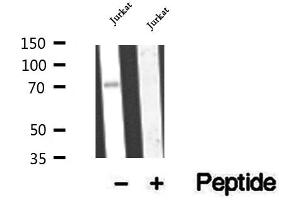 Western blot analysis of extracts of Jurkat cells, using CCDC93 antibody. (CCDC93 抗体  (C-Term))
