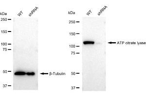 Western blotting analysis using ATP citrate lyase antibody (ABIN7797679). (Recombinant ACLY 抗体)
