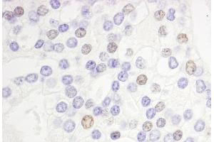 anti-DEK Oncogene (DEK) (AA 225-275) antibody