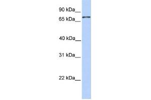 WB Suggested Anti-COLEC12 Antibody Titration:  0. (COLEC12 抗体  (N-Term))
