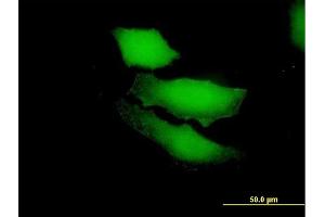 Immunofluorescence of purified MaxPab antibody to RGS13 on HeLa cell. (RGS13 抗体  (AA 1-159))