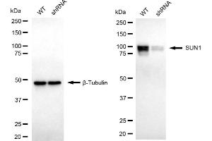 Western blotting analysis using SUN1 antibody (ABIN7800268). (Recombinant SUN1 抗体)
