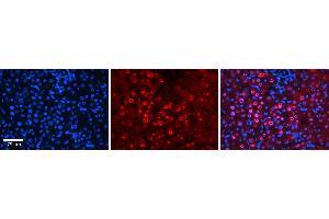 Rabbit Anti-FOS Antibody  AV Formalin Fixed Paraffin Embedded Tissue: Human Liver Tissue Observed Staining: Nucleus in hepatocytes Primary Antibody Concentration: 1:100 Other Working Concentrations: 1:600 Secondary Antibody: Donkey anti-Rabbit-Cy3 Secondary Antibody Concentration: 1:200 Magnification: 20X Exposure Time: 0. (c-FOS 抗体  (N-Term))