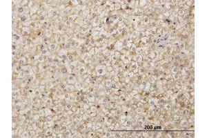 Image no. 1 for anti-Stromal Cell Derived Factor 2 (SDF2) (AA 1-212) antibody (ABIN598919) (SDF2 抗体  (AA 1-212))