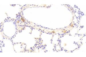 Detection of IFNb in Rat Lung Tissue using Monoclonal Antibody to Interferon Beta (IFNb) (IFNB1 抗体  (AA 23-169))