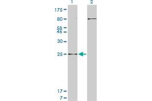 Western Blot analysis of HOXB7 expression in transfected 293T cell line by HOXB7 monoclonal antibody (M04), clone 5B2. (HOXB7 抗体  (AA 55-120))