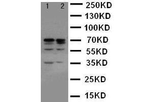 Anti-Lamin A+C antibody, Western blotting Lane 1: HELA Cell Lysate Lane 2: A431 Cell Lysate (Lamin A/C 抗体  (C-Term))