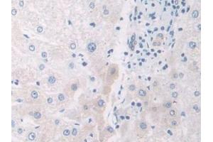 Detection of IL12A in Human Liver Tissue using Polyclonal Antibody to Interleukin 12A (IL12A) (IL12A 抗体  (AA 23-219))