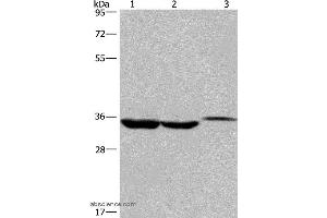 Western blot analysis of Lovo cell,human liver cancer tissue and mouse kidney tissue, using ING2 Polyclonal Antibody at dilution of 1:425 (ING2 抗体)