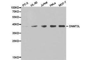 Western Blotting (WB) image for anti-DNA (Cytosine-5-)-Methyltransferase 3 Like (TRDMT1) antibody (ABIN1872332) (DNMT3L 抗体)