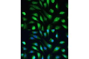 Immunofluorescence analysis of U-2 OS cells using Galectin 3/Galectin 3/LG antibody (ABIN6130437, ABIN6143158, ABIN6143159 and ABIN7101422) at dilution of 1:100. (Galectin 3 抗体  (AA 1-250))