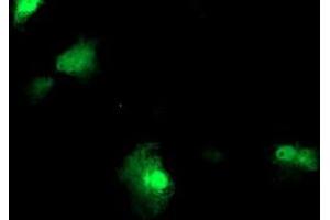 Anti-FBXO21 mouse monoclonal antibody (ABIN2455306) immunofluorescent staining of COS7 cells transiently transfected by pCMV6-ENTRY FBXO21 (RC223095). (FBXO21 抗体)